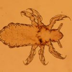 Infestazione pidocchi