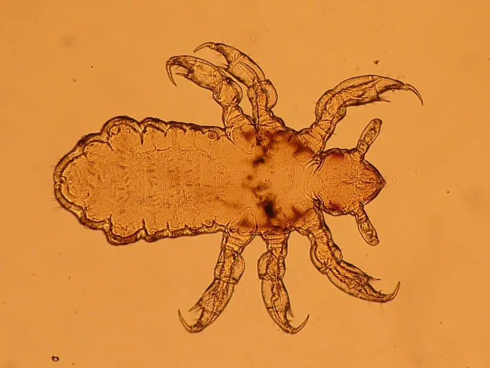 Infestazione pidocchi